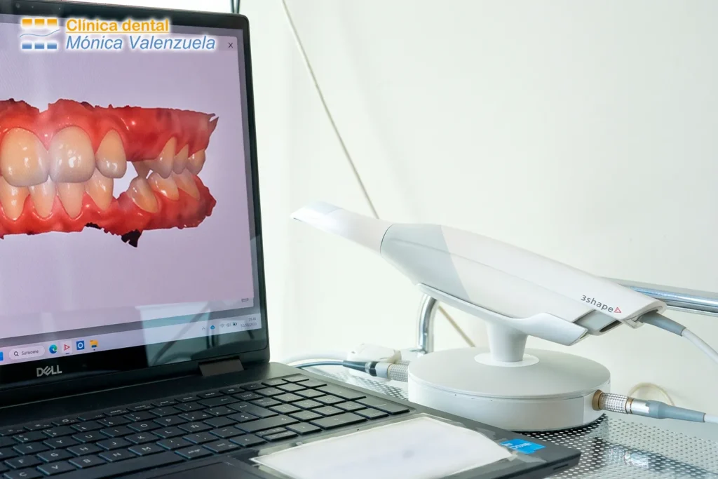 scanner-clinica-dental-valenzuela 3shape